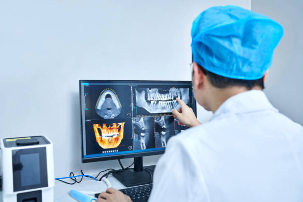 Best Emergency Tooth Extraction in Baker, MT